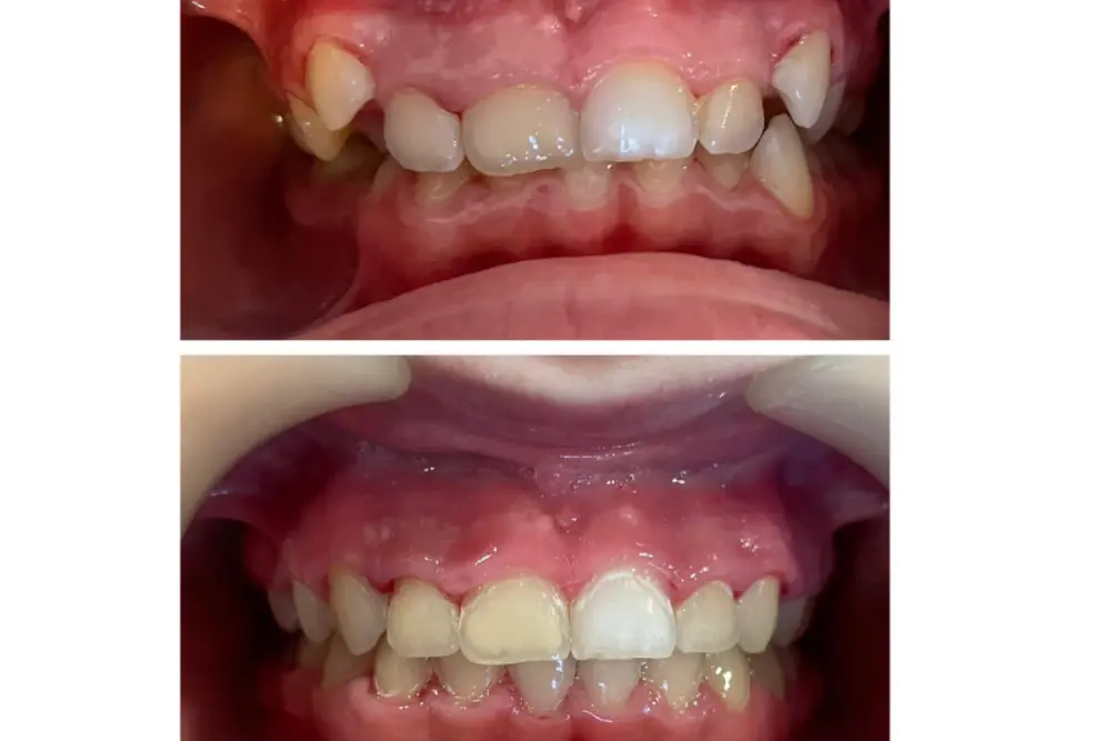 dentaldermaart-drauroraborodi-consultatie (1)