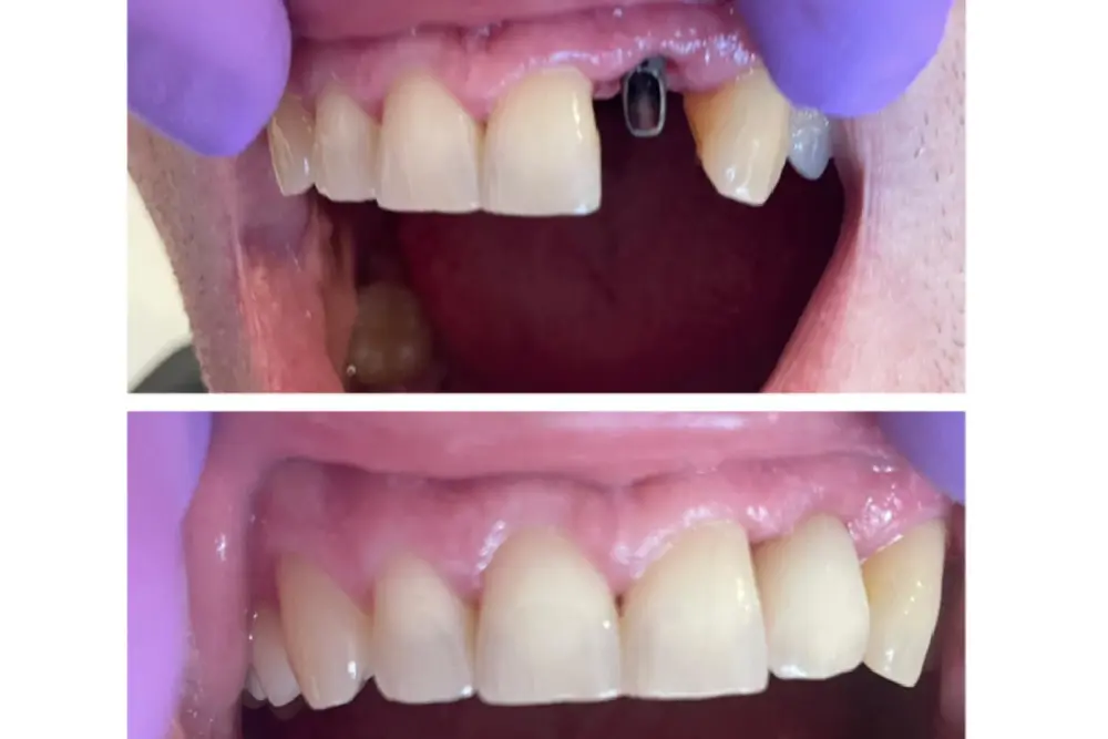 dentaldermaart-drauroraborodi-consultatie (2)