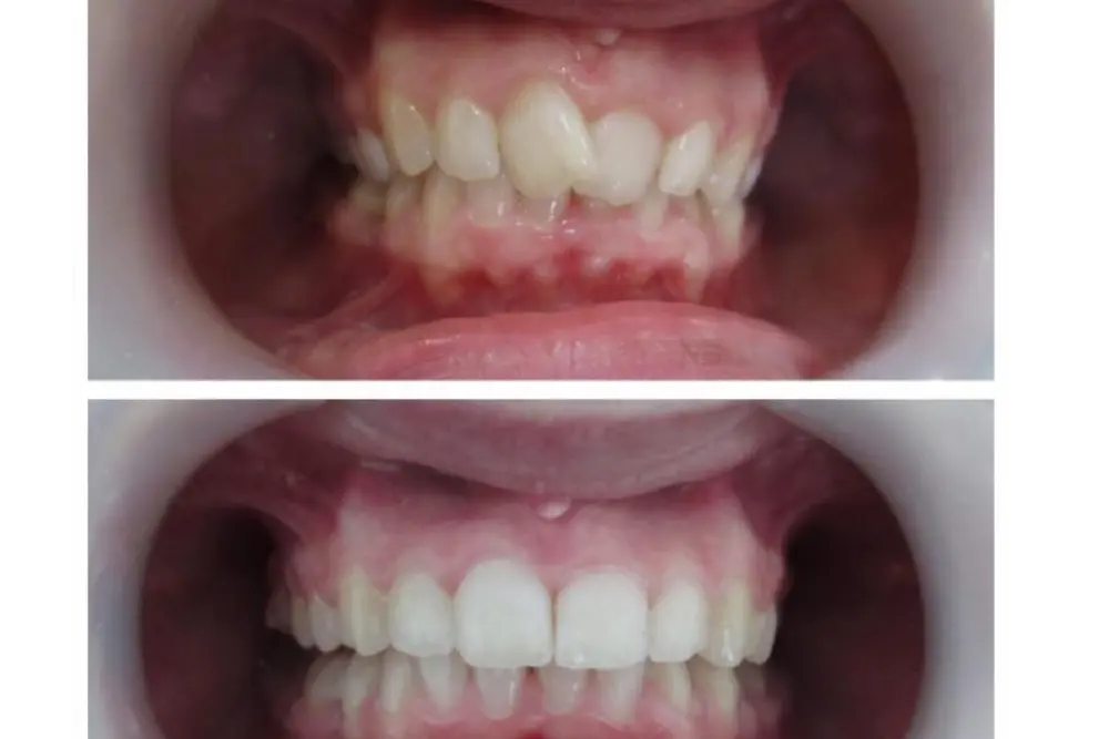 dentaldermaart-drauroraborodi-consultatie (3)