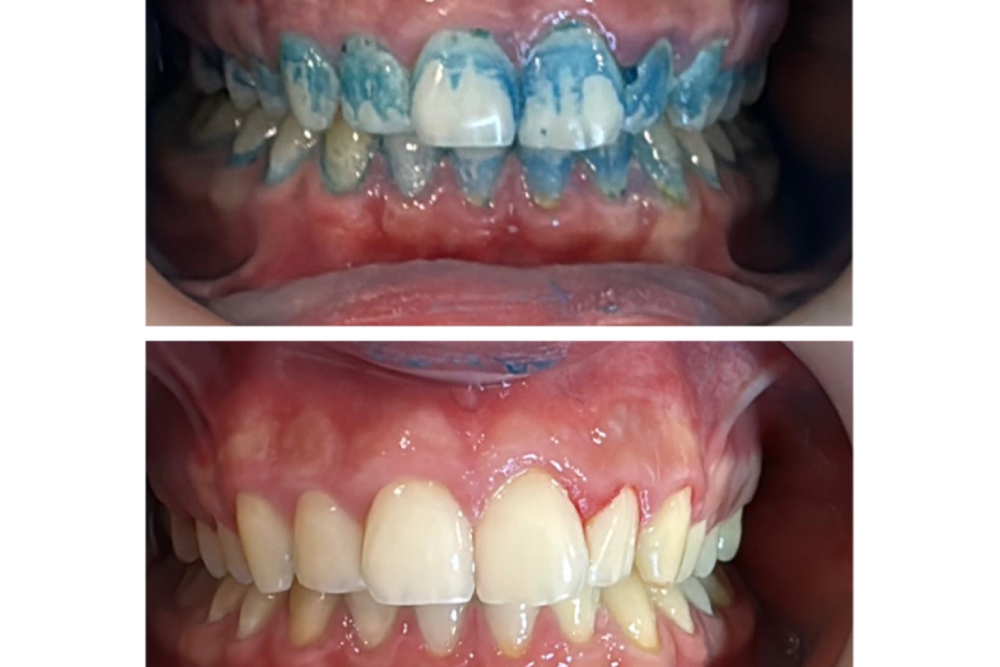 dentaldermaart-drauroraborodi-consultatie