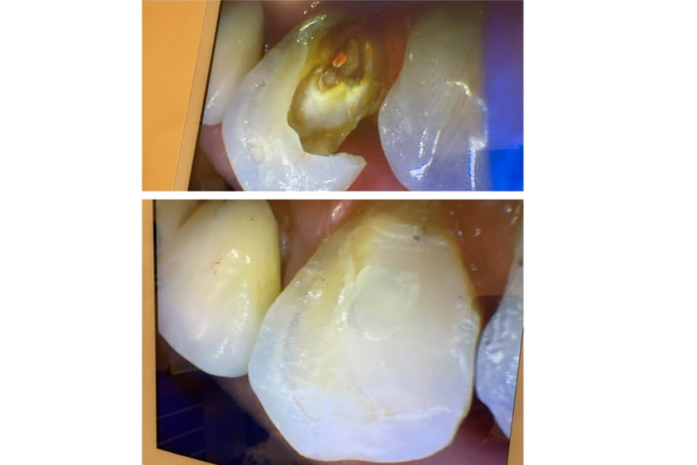 dentaldermaart-drauroraborodi-odontologie